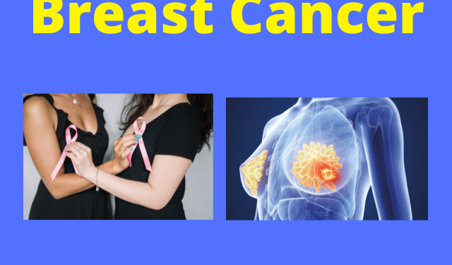 Breast Cancer Breast Cancer